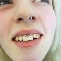 David Detre: Piercing, Septum Smiley, Nase, Lippenbaendchen