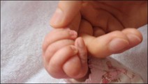Alles zum Thema Babypflege, Storchenbiss, Milchschorf, wunder Po