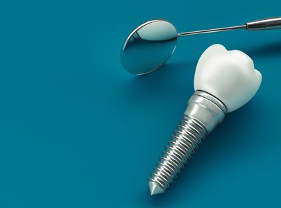 Dr. Wegdell Hamburg Zahnimplantate