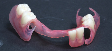 Prothesen aus Valplast