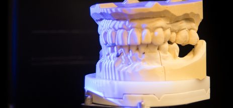 CAD-CAM-Verfahren